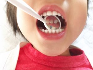 予防の大切さ。伝えたつもりでも患者さんには伝わっていないかも?